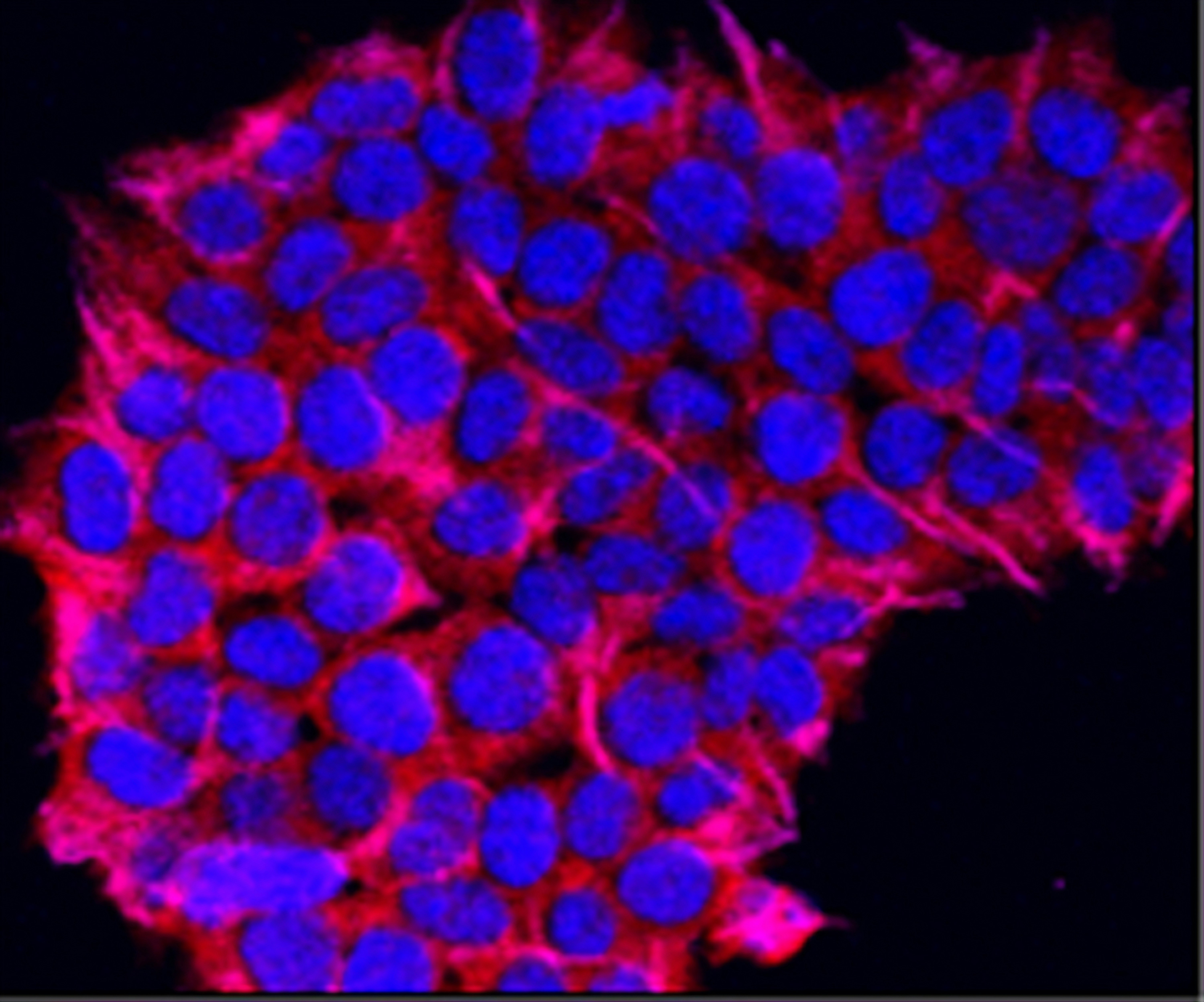 A group of cells under fluorescence microscopy similar to those worked on by Danny Collinson